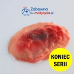 Okrągła rana do pozoracji