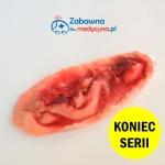 Podłużna rana do pozoracji