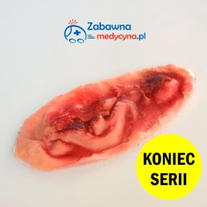 Podłużna rana do pozoracji